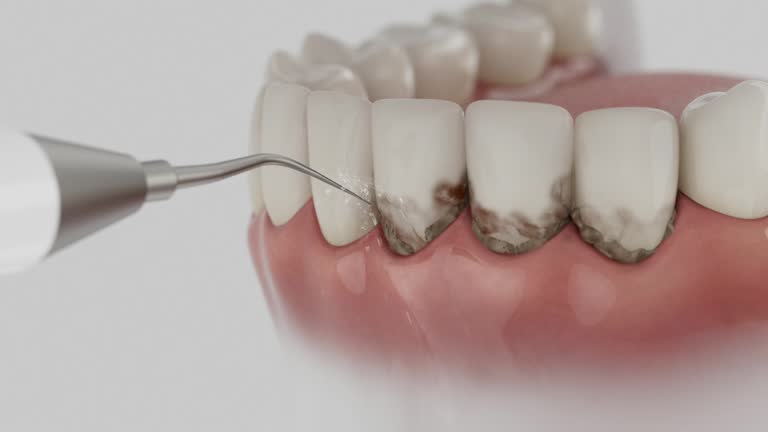 Reliable Dental contractor in Hartford, SD by Smile Center Dentistry